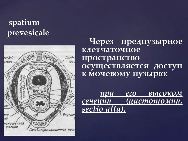 spatium prevesicale Через предпузырное клетчаточное пространство осуществляется доступ к мочевому пузырю: