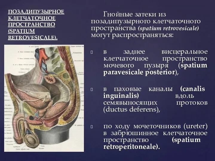 ПОЗАДИПУЗЫРНОЕ КЛЕТЧАТОЧНОЕ ПРОСТРАНСТВО (SPATIUM RETROVESICALE). Гнойные затеки из позадипузырного клетчаточного пространства