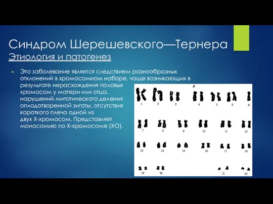 Синдром Шерешевского—Тернера Этиология и патогенез Это заболевание является следствием разнообразных отклонений