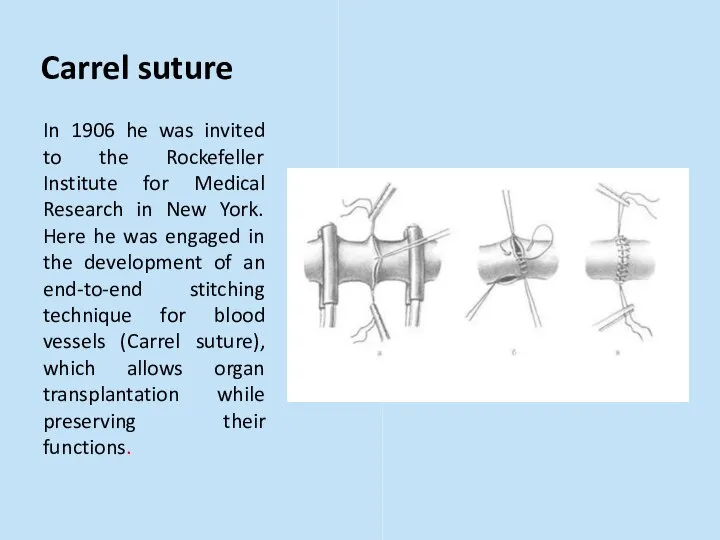 Carrel suture In 1906 he was invited to the Rockefeller Institute