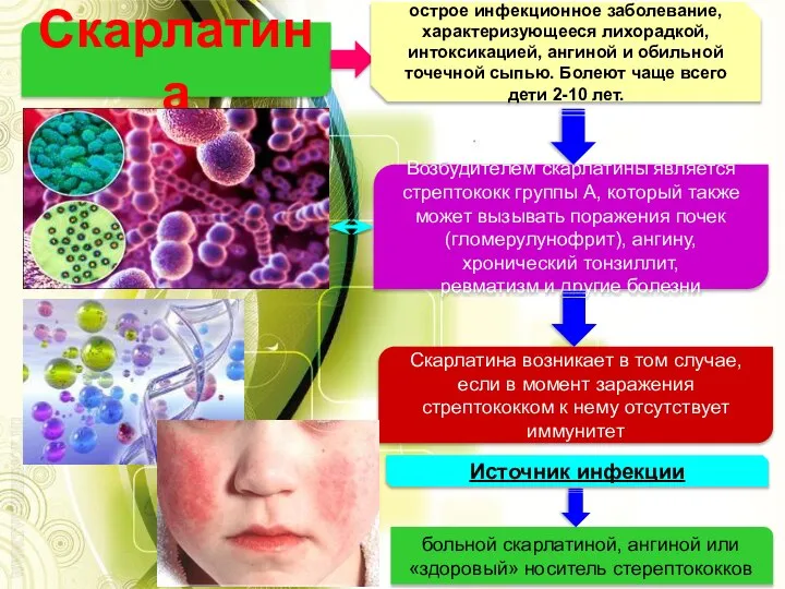 Скарлатина острое инфекционное заболевание, характеризующееся лихорадкой, интоксикацией, ангиной и обильной точечной