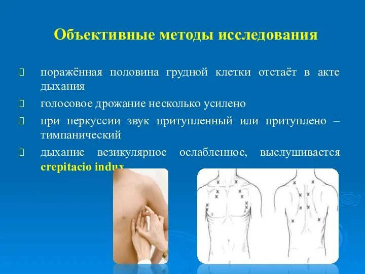 Объективные методы исследования поражённая половина грудной клетки отстаёт в акте дыхания