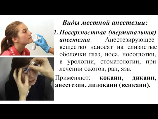 Виды местной анестезии: Поверхностная (терминальная) анестезия. Анестезирующее вещество наносят на слизистые