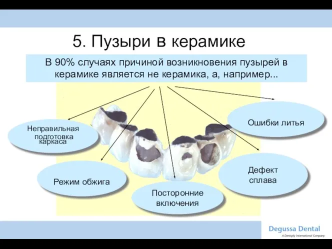 Ошибки литья Режим обжига Неправильная подготовка каркаса 5. Пузыри в керамике