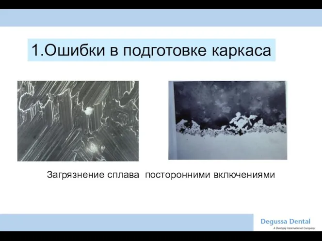 Загрязнение сплава посторонними включениями 1.Ошибки в подготовке каркаса