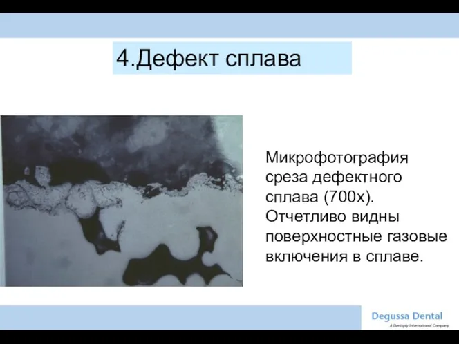 Микрофотография среза дефектного сплава (700x). Отчетливо видны поверхностные газовые включения в сплаве. 4.Дефект сплава