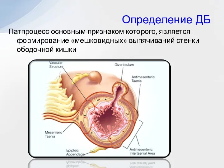 Определение ДБ Патпроцесс основным признаком которого, является формирование «мешковидных» выпячиваний стенки ободочной кишки