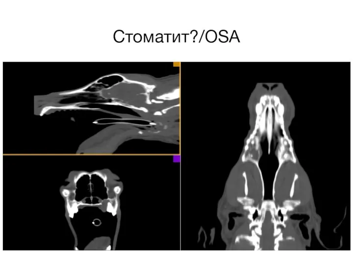 Стоматит?/OSA