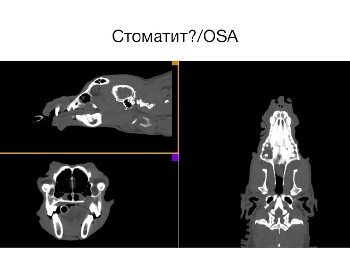 Стоматит?/OSA