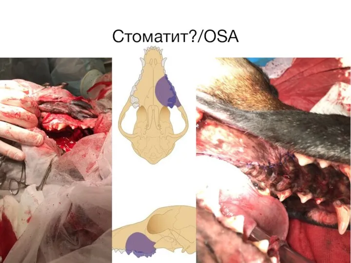 Стоматит?/OSA