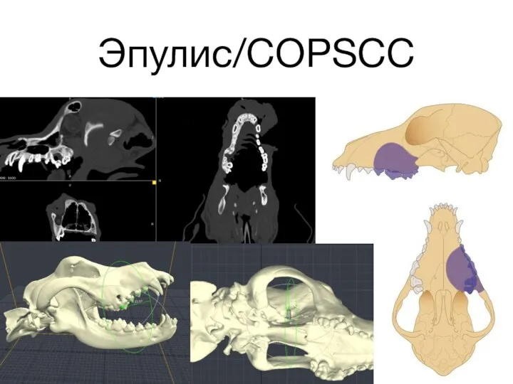 Эпулис/COPSCC