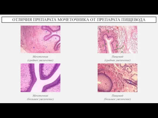 ОТЛИЧИЯ ПРЕПАРАТА МОЧЕТОЧНИКА ОТ ПРЕПАРАТА ПИЩЕВОДА Мочеточник (среднее увеличение) Мочеточник (большое