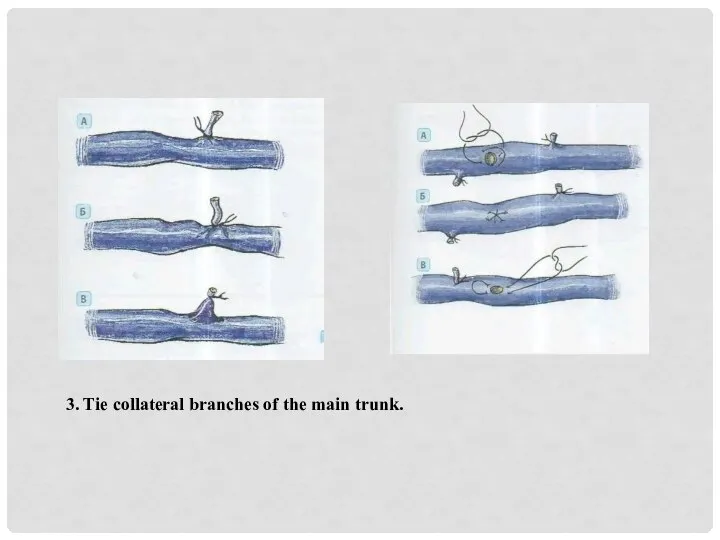 3. Tie collateral branches of the main trunk.