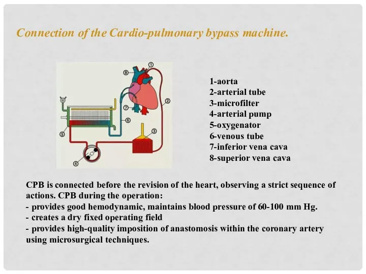 Connection of the Cardio-pulmonary bypass machine. CPB is connected before the