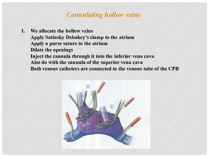 Cannulating hollow veins We allocate the hollow veins Apply Satinsky Debakey’s