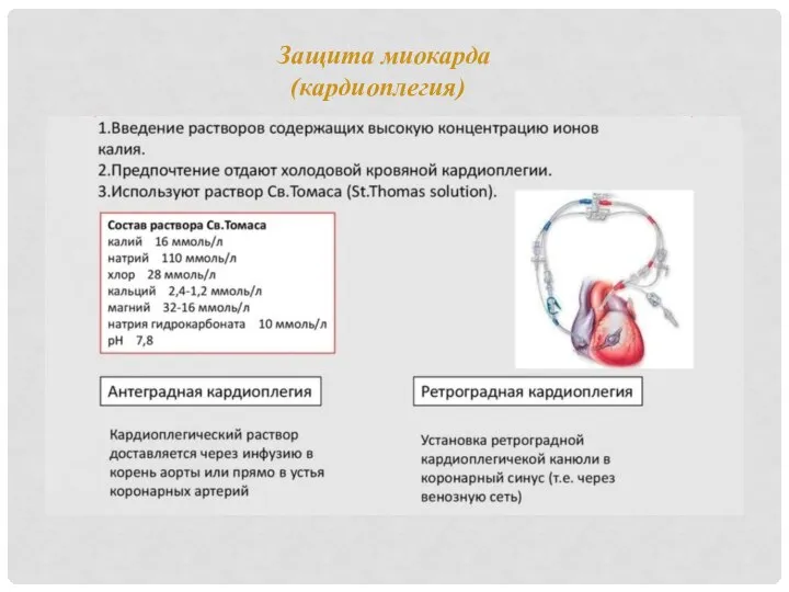 Защита миокарда (кардиоплегия)