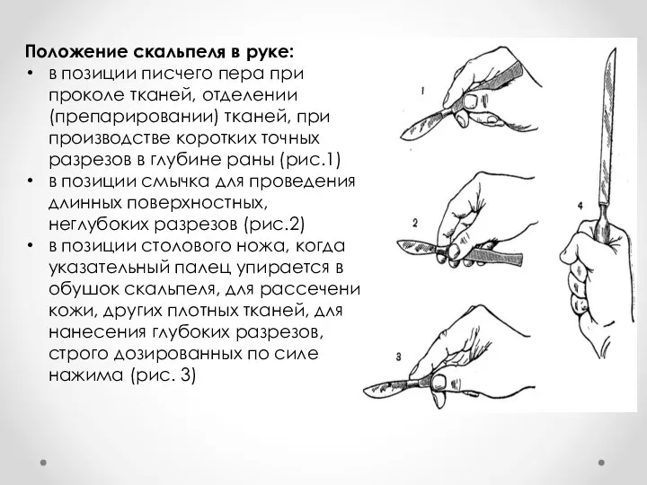 Положение скальпеля в руке: в позиции писчего пера при проколе тканей,