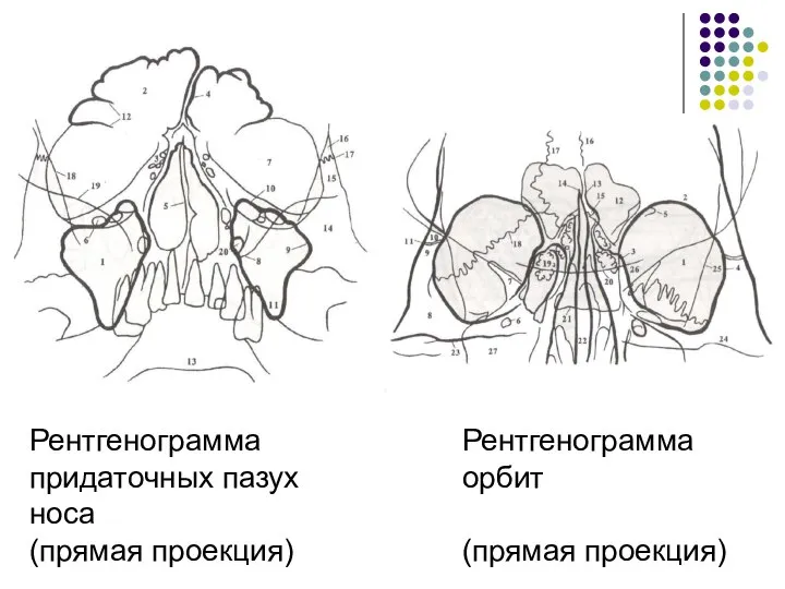 Рентгенограмма придаточных пазух носа (прямая проекция) Рентгенограмма орбит (прямая проекция)