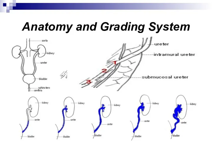 Anatomy and Grading System