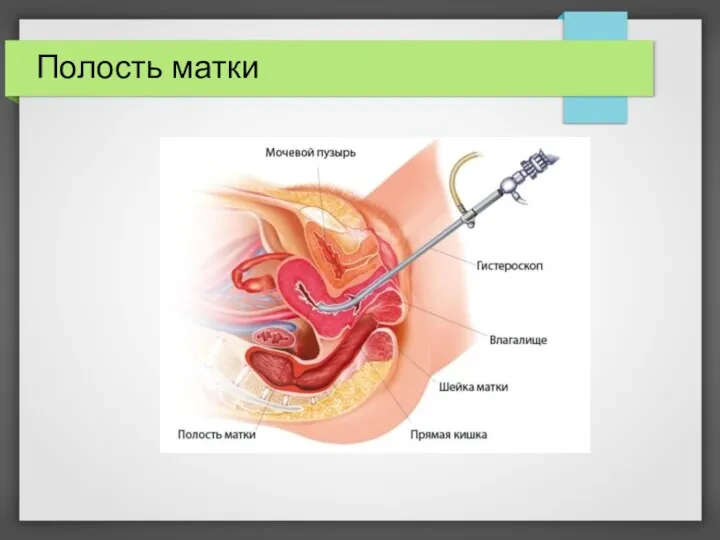 Полость матки