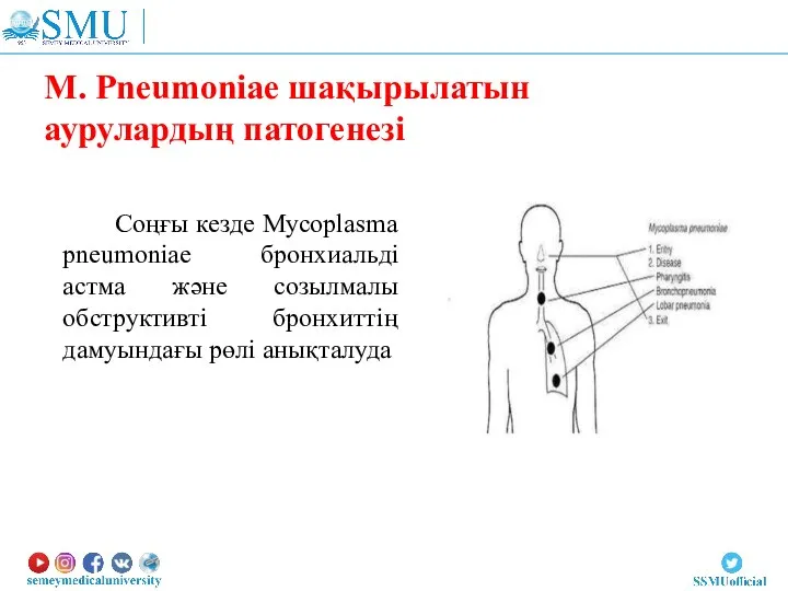 M. Pneumoniae шақырылатын аурулардың патогенезі Соңғы кезде Mycoplasma pneumoniae бронхиальді астма