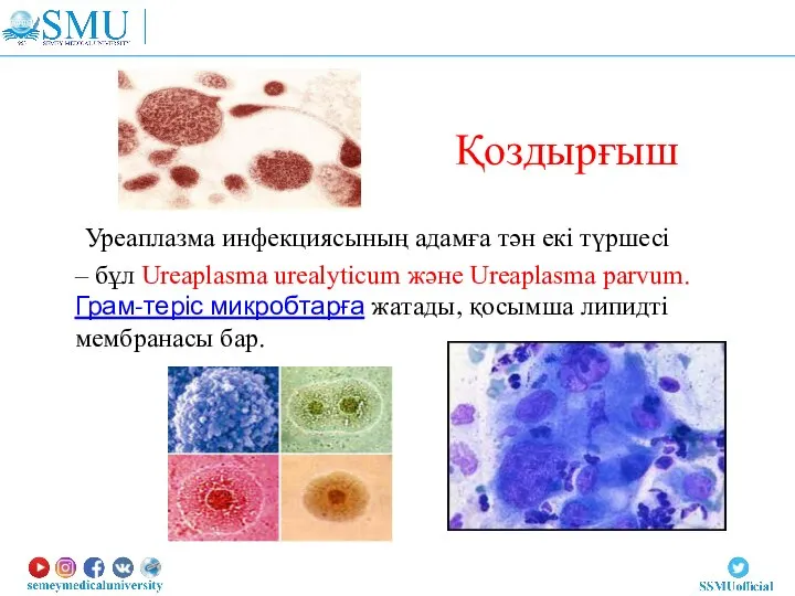 Қоздырғыш Уреаплазма инфекциясының адамға тән екі түршесі – бұл Ureaplasma urealyticum