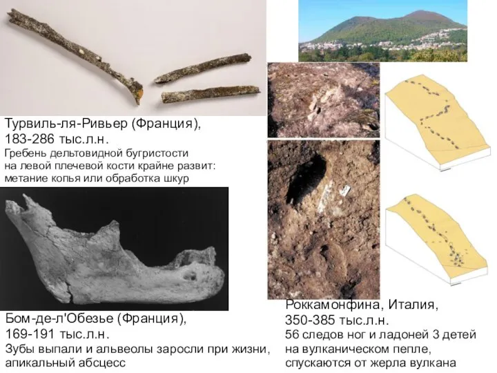 Турвиль-ля-Ривьер (Франция), 183-286 тыс.л.н. Гребень дельтовидной бугристости на левой плечевой кости