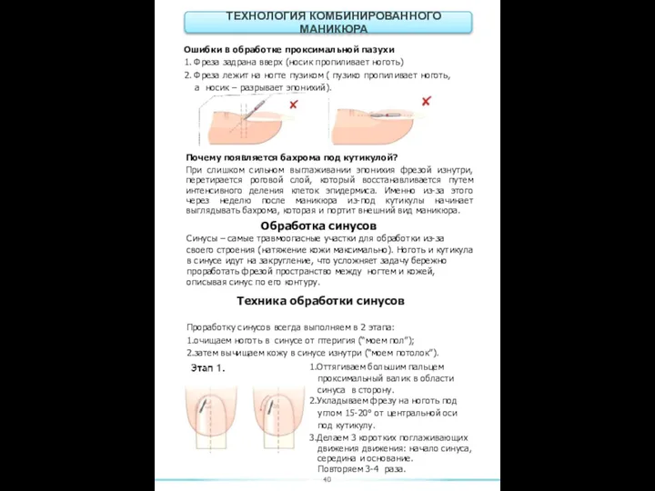 Ошибки в обработке проксимальной пазухи 1. Фреза задрана вверх (носик пропиливает