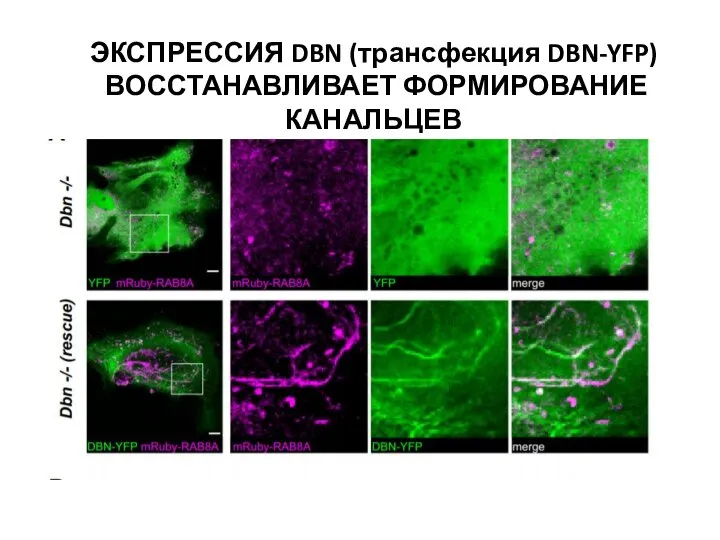 ЭКСПРЕССИЯ DBN (трансфекция DBN-YFP) ВОССТАНАВЛИВАЕТ ФОРМИРОВАНИЕ КАНАЛЬЦЕВ