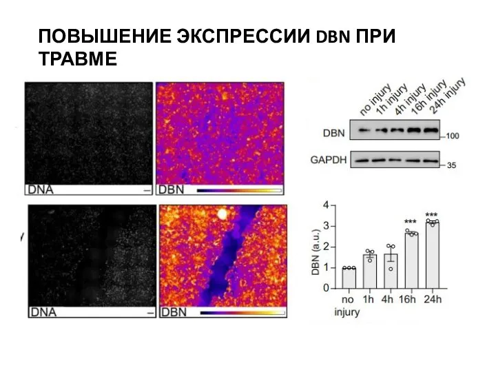 ПОВЫШЕНИЕ ЭКСПРЕССИИ DBN ПРИ ТРАВМЕ