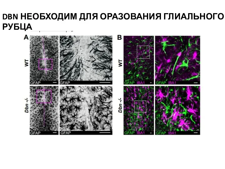 DBN НЕОБХОДИМ ДЛЯ ОРАЗОВАНИЯ ГЛИАЛЬНОГО РУБЦА
