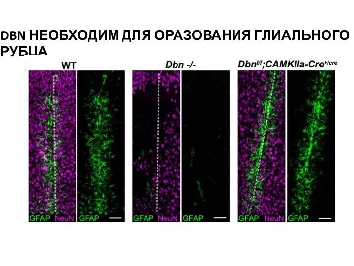 DBN НЕОБХОДИМ ДЛЯ ОРАЗОВАНИЯ ГЛИАЛЬНОГО РУБЦА