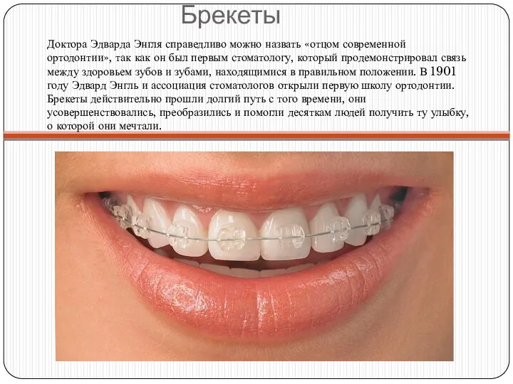 Брекеты Доктора Эдварда Энгля справедливо можно назвать «отцом современной ортодонтии», так