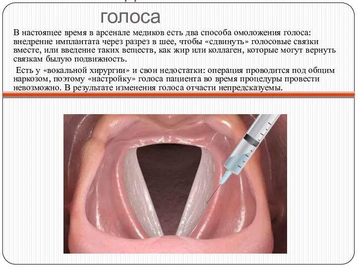 Подтяжка голоса В настоящее время в арсенале медиков есть два способа