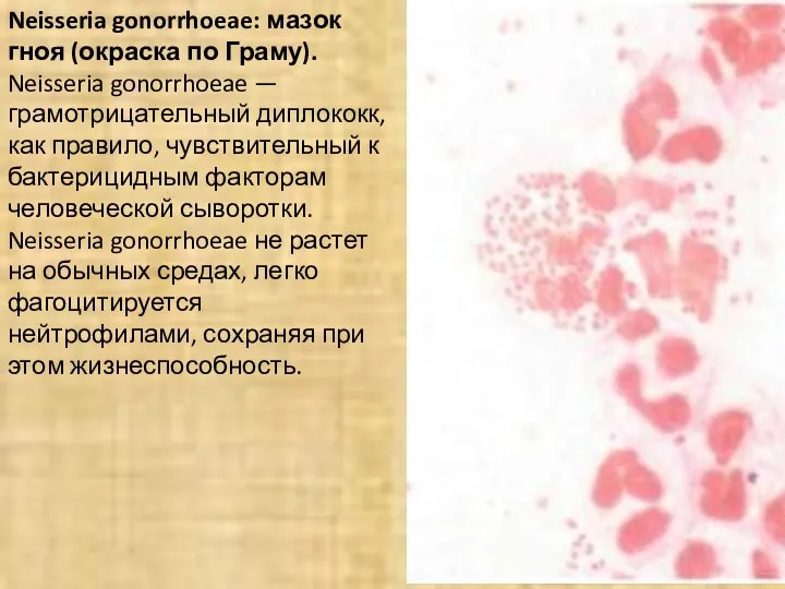 Neisseria gonorrhoeae: мазок гноя (окраска по Граму). Neisseria gonorrhoeae — грамотрицательный