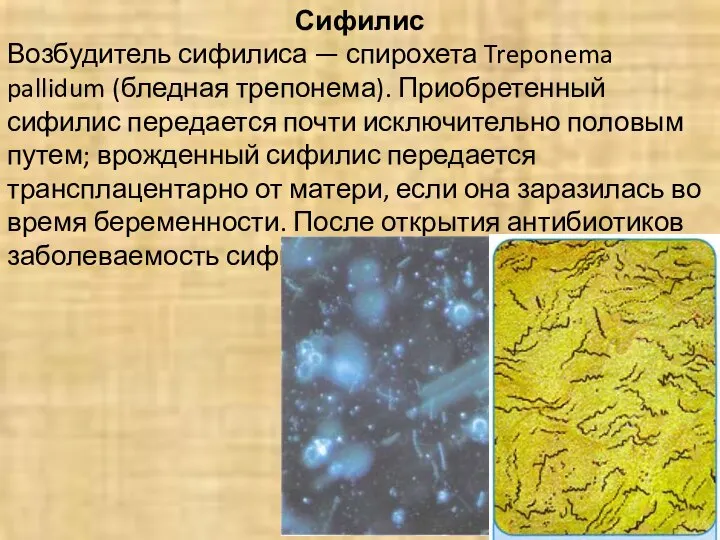 Сифилис Возбудитель сифилиса — спирохета Treponema pallidum (бледная трепонема). Приобретенный сифилис