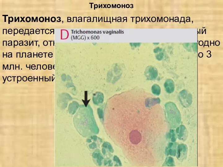 Трихомоноз Трихомоноз, влагалищная трихомонада, передается половым путем, она жгутиковый паразит, относящийся