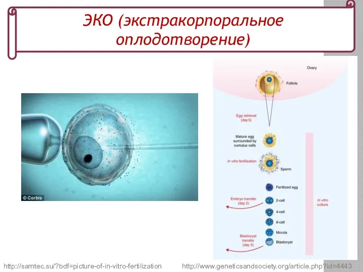 http://www.geneticsandsociety.org/article.php?id=4443 ЭКО (экстракорпоральное оплодотворение) http://samtec.su/?bdf=picture-of-in-vitro-fertilization