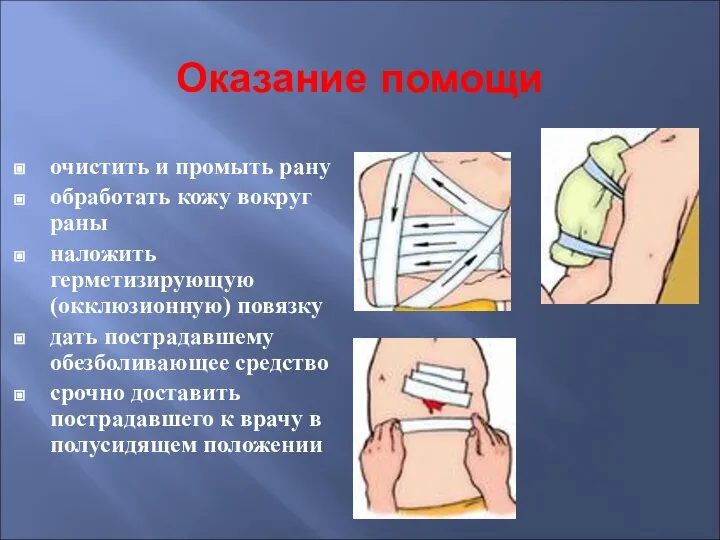 Оказание помощи очистить и промыть рану обработать кожу вокруг раны наложить