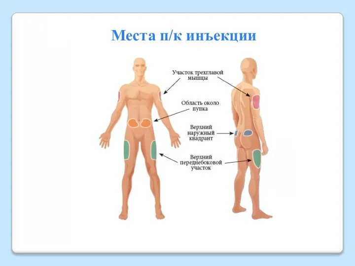 Места п/к инъекции