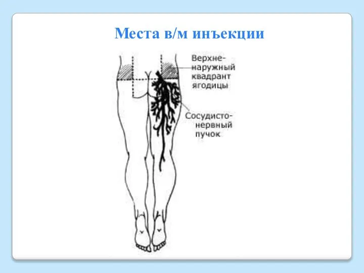 Места в/м инъекции