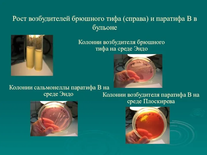 Рост возбудителей брюшного тифа (справа) и паратифа В в бульоне Колонии