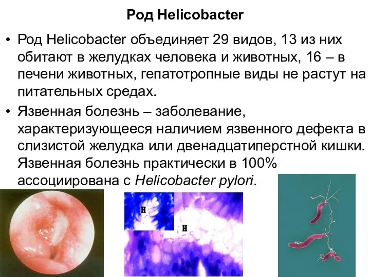 Род Helicobacter Род Helicobacter объединяет 29 видов, 13 из них обитают