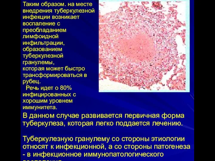 Таким образом. на месте внедрения туберкулезной инфекции возникает воспаление с преобладанием