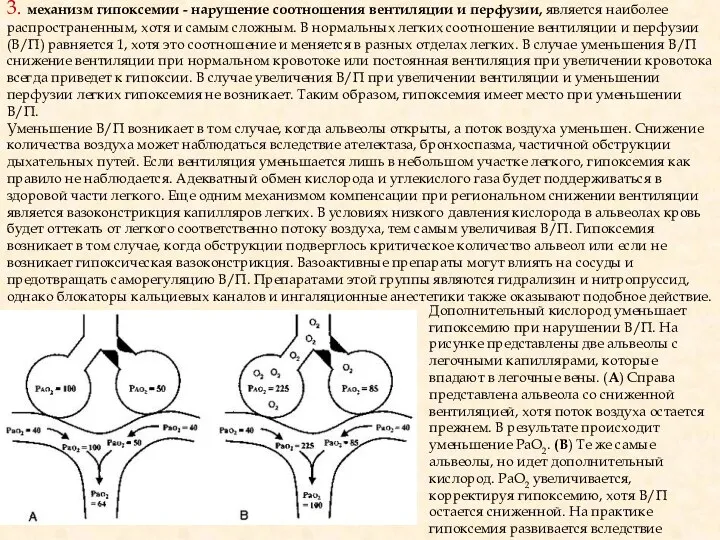 Дополнительный кислород уменьшает гипоксемию при нарушении В/П. На рисунке представлены две