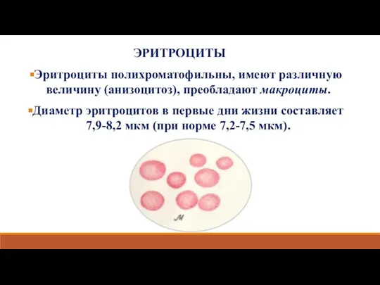 ЭРИТРОЦИТЫ Эритроциты полихроматофильны, имеют различную величину (анизоцитоз), преобладают макроциты. Диаметр эритроцитов