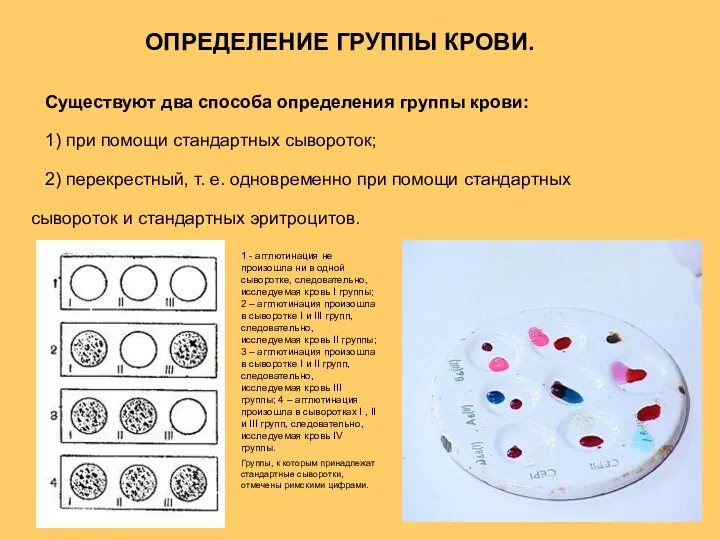 ОПРЕДЕЛЕНИЕ ГРУППЫ КРОВИ. Существуют два способа определения группы крови: 1) при