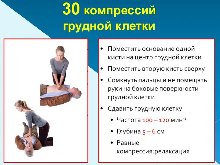 30 компрессий грудной клетки