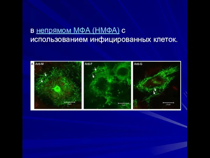 в непрямом МФА (НМФА) с использованием инфицированных клеток.