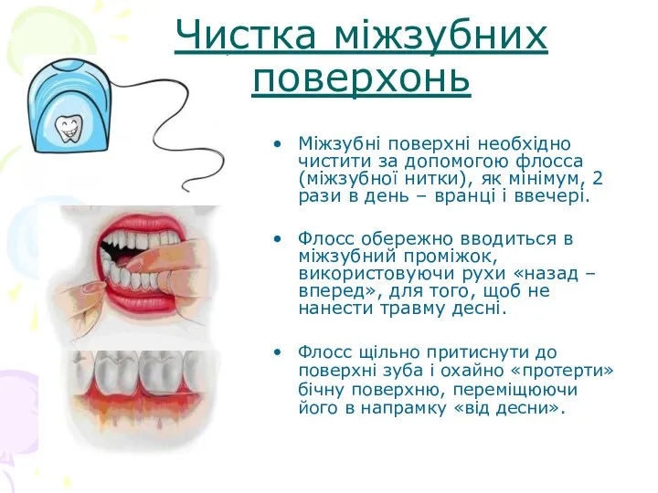 Чистка міжзубних поверхонь Міжзубні поверхні необхідно чистити за допомогою флосса (міжзубної